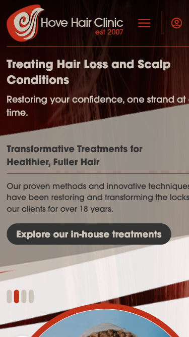 Hove Hair Clinic website on mobile