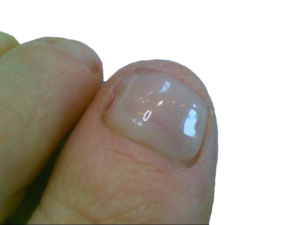 Gel Nail Reconstruction