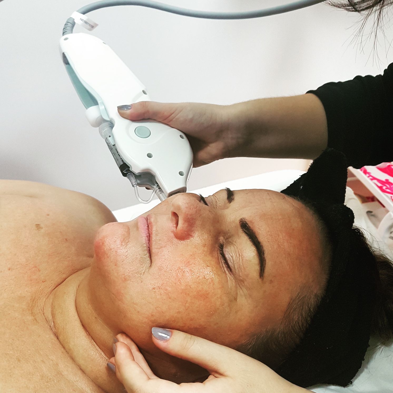 No-Needle MesoTherapy