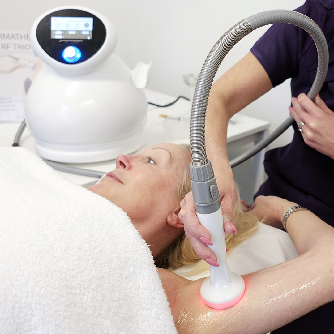 Radio Frequency Skin Tightening