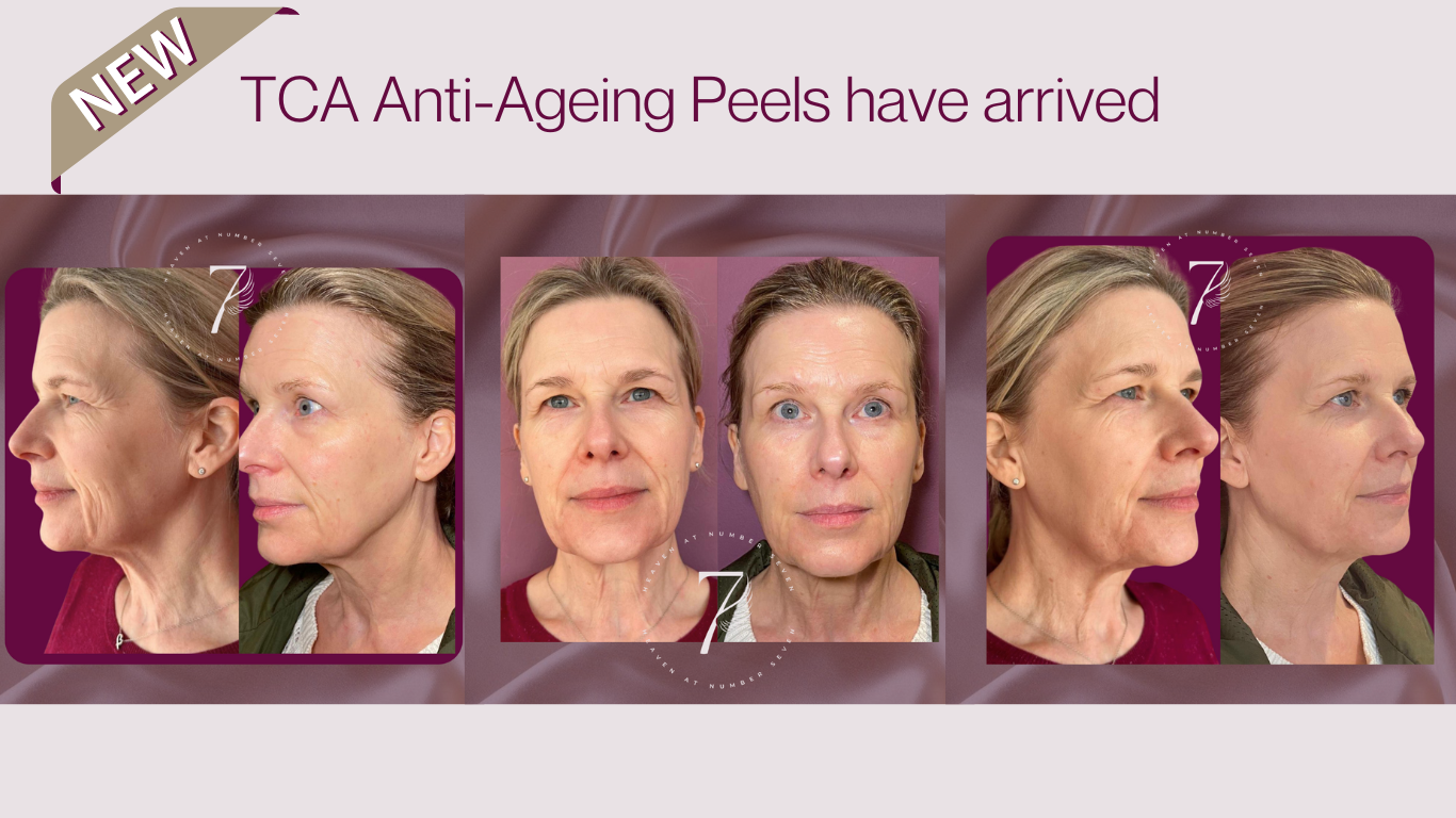 Discover NEW TCA Peels