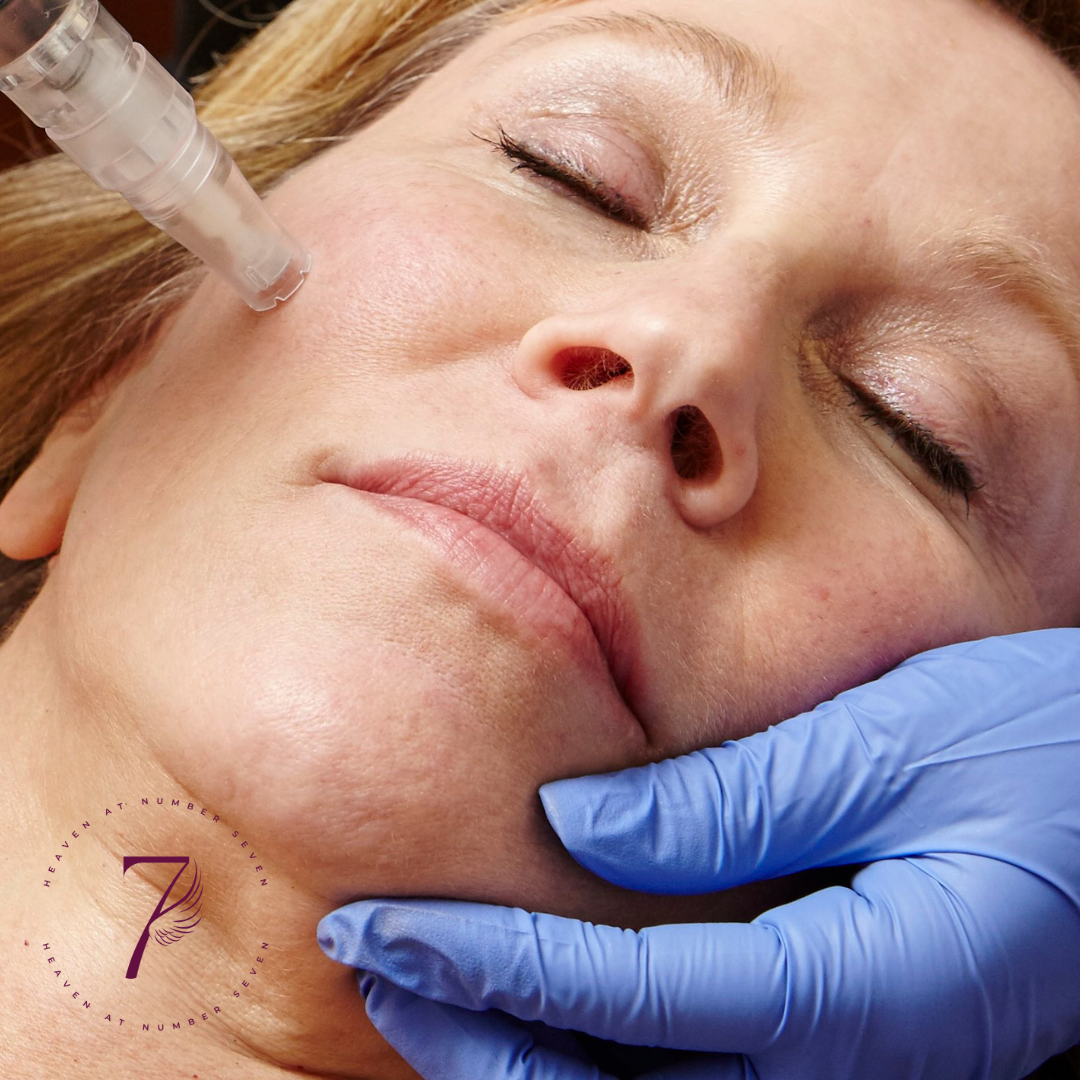 Microneedling For Real Results: Who It’s For, How It Feels, And What To Expect