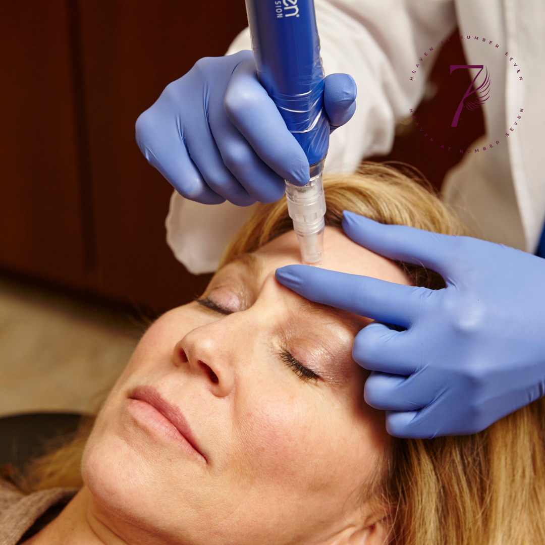 Microneedling After 40: Results, Downtime and UK Pricing Guide