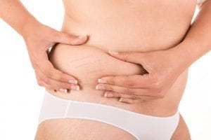 a woman squeezing the fat on her hip to show lipo-contrast-love-handle-removal fat loss treatment