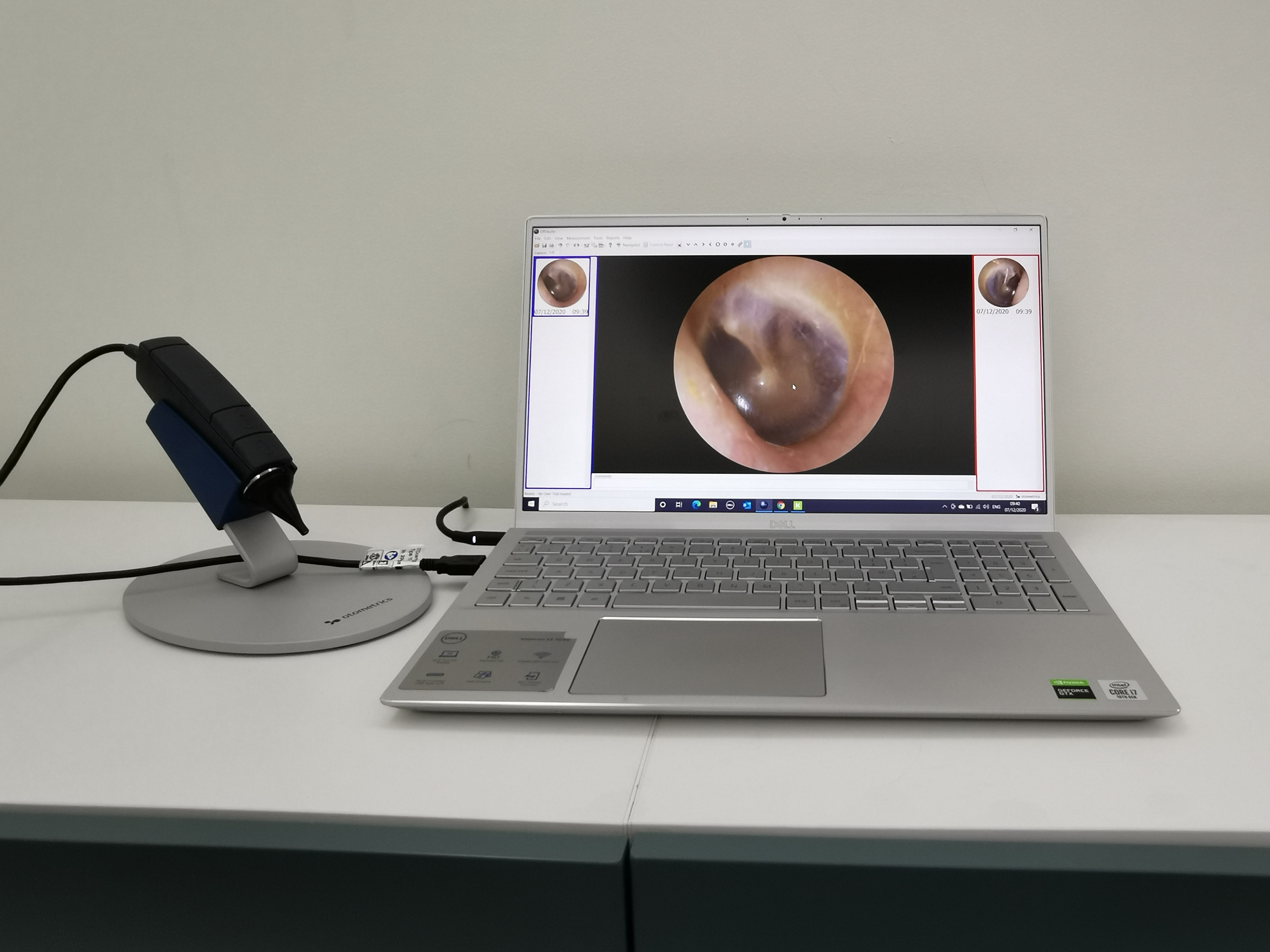 Laptop Otoscope