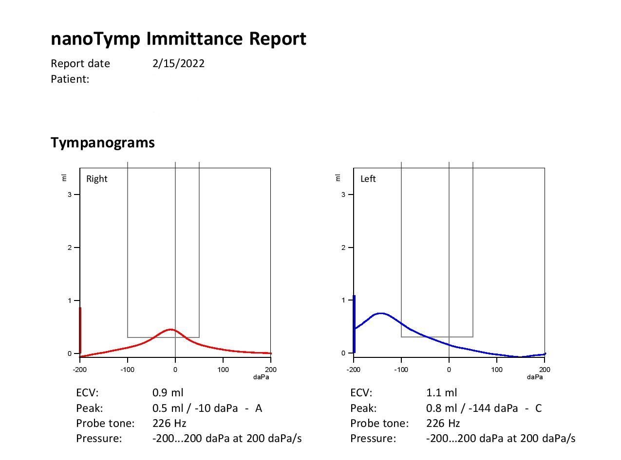 Tympanometry Immittance Report