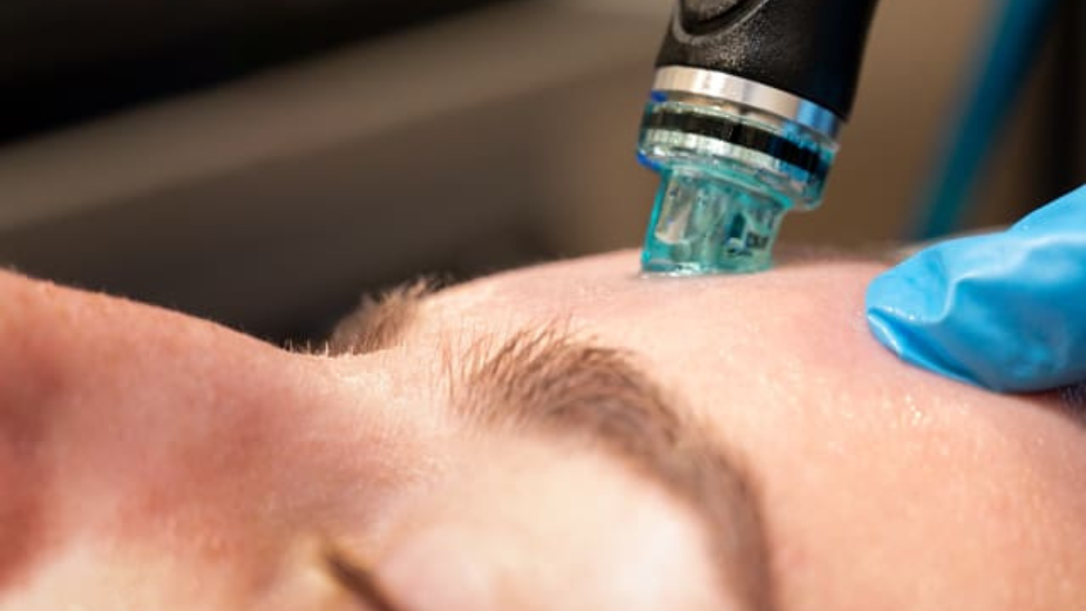 hydrafacial edinburgh