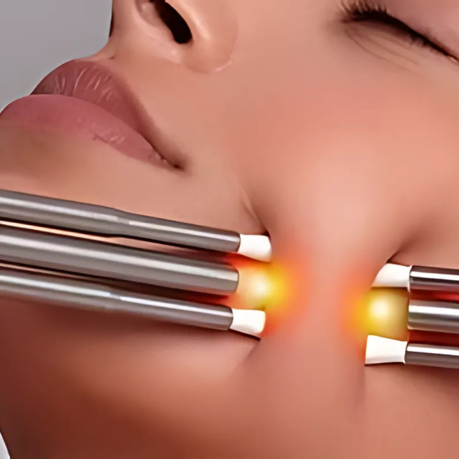CACI Synergy Non-Surgical Facial Toning