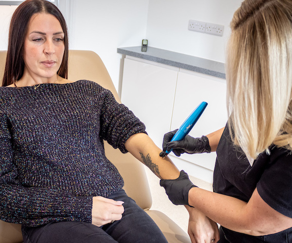 Save £20 with Cryopen Age Spots/ Hyper Pigmented Removal Treatment