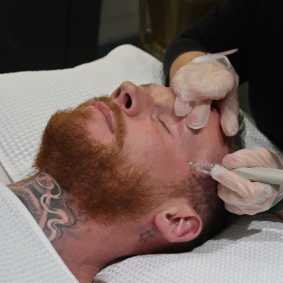 DermaQuest Resurfacer & Medical Microdermabrasion for Men