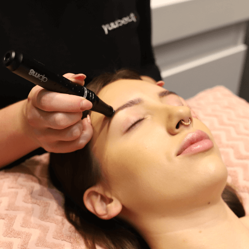Dermapen Face & Neck