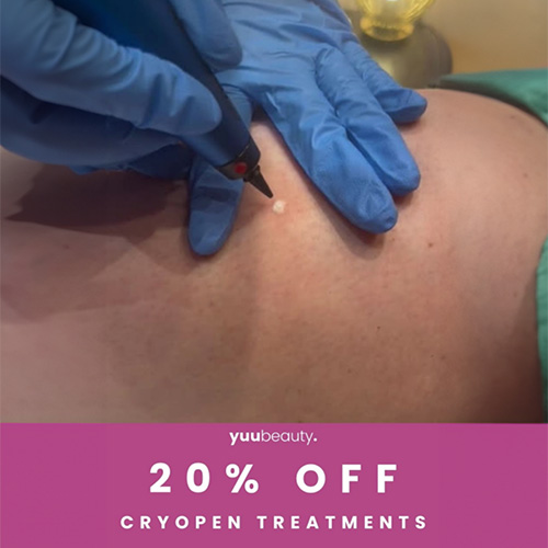 20% off Cryopen Treatments