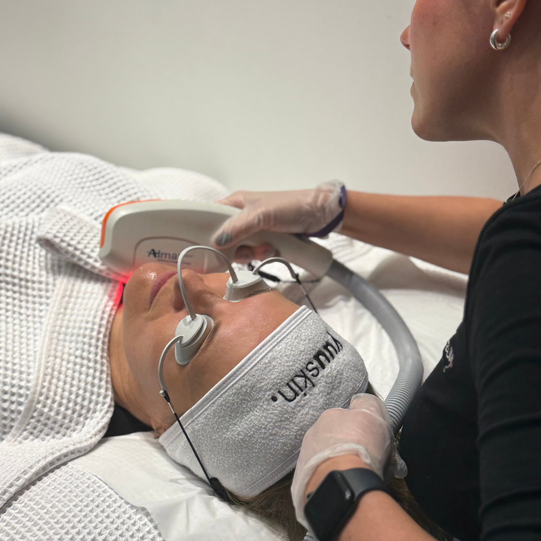 Save 20% Soprano Skin Tightening