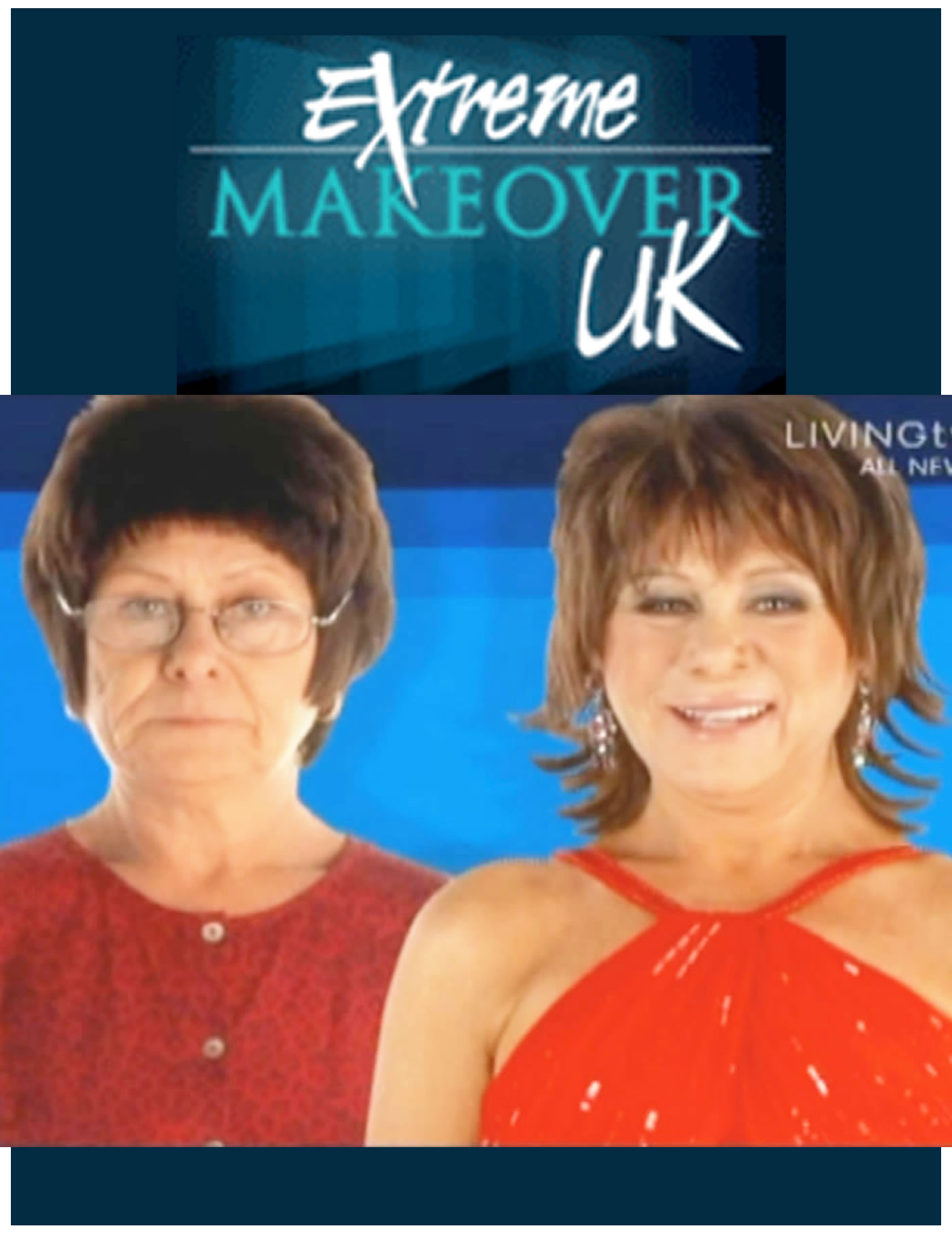 Extreme Makeover UK TV - from Hair Loss Wig to MG's Kinsey System