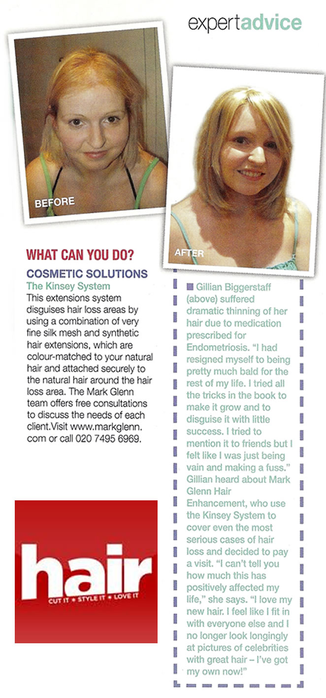 Hair Magazine - 'Coping with female hair loss'
