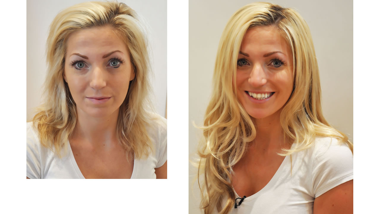 Bleach damaged hair - before and after hair extensions pictures - Mark Glenn