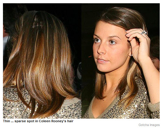 Thin... sparse spot in Coleen Rooney's hair