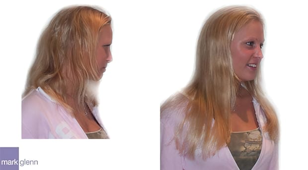 HE018 - Home Bleaching Damage Repaired with Hair Extensions - Mark Glenn, London, UK