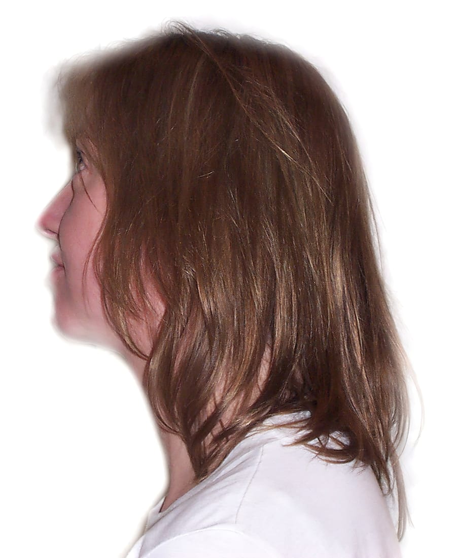Before Picture - Shoulder Length Body Booster