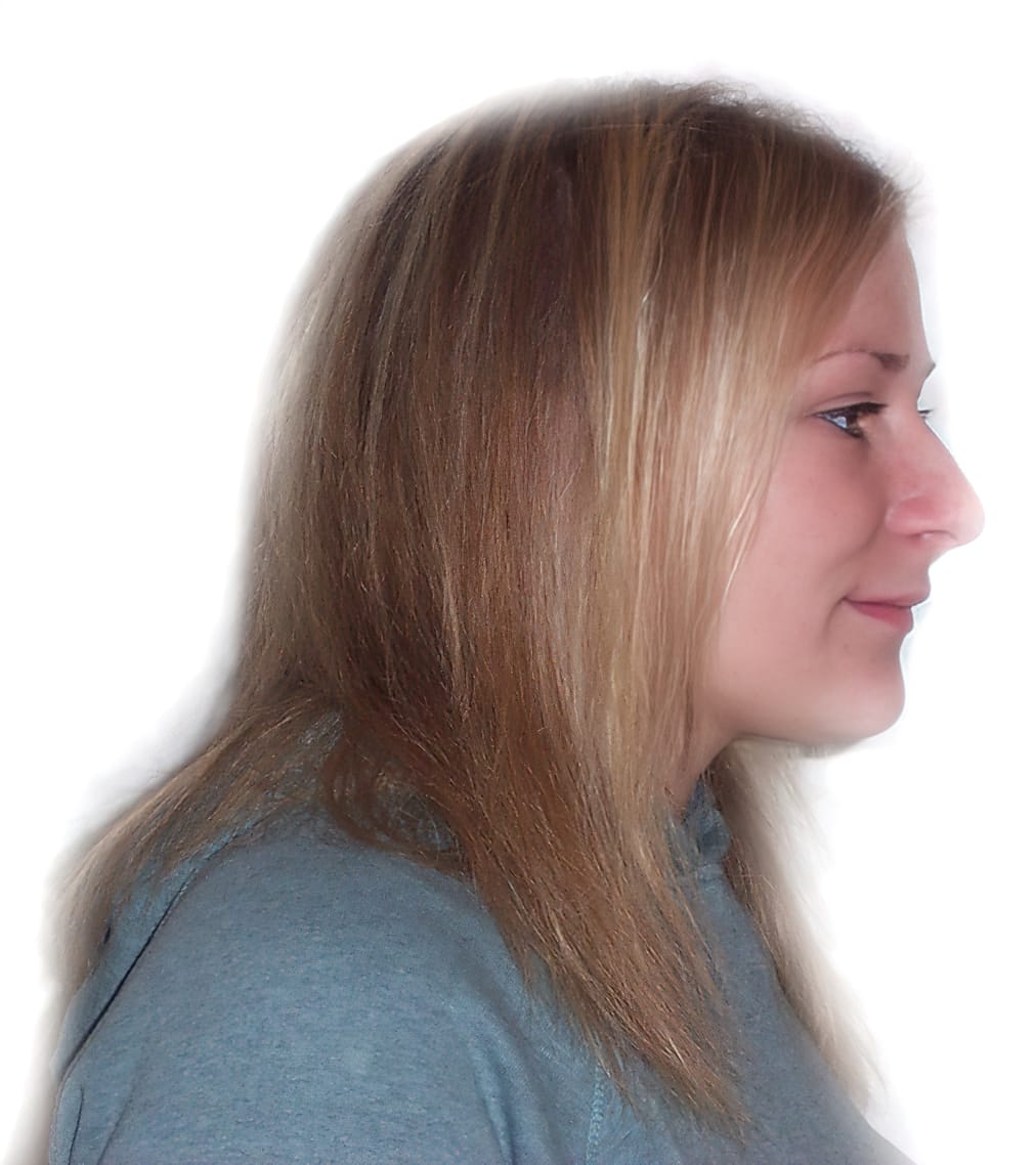 Before Picture - Subtle Lift & Thicken