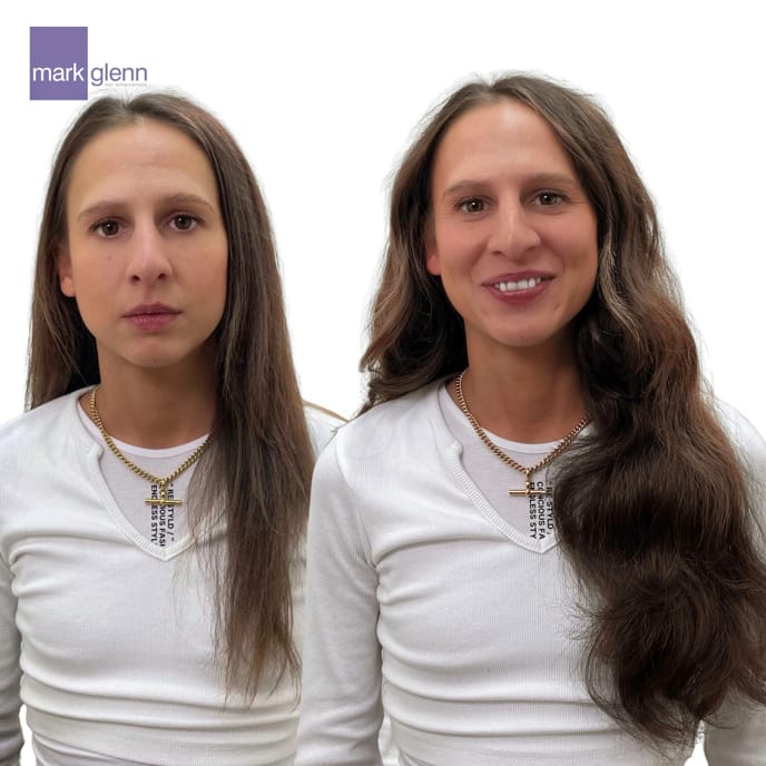 Fragile Hair Restored After Human Tape Extensions Damage