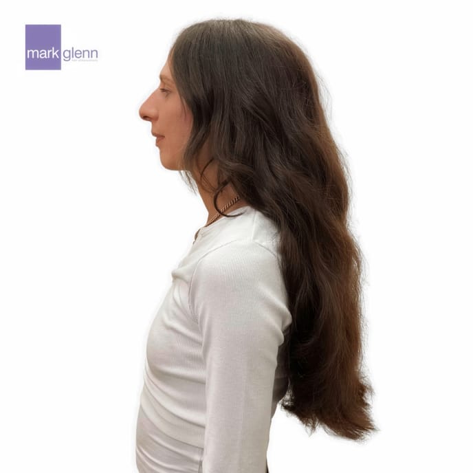 After Picture - Fragile Hair Restored After Human Tape Extensions Damage