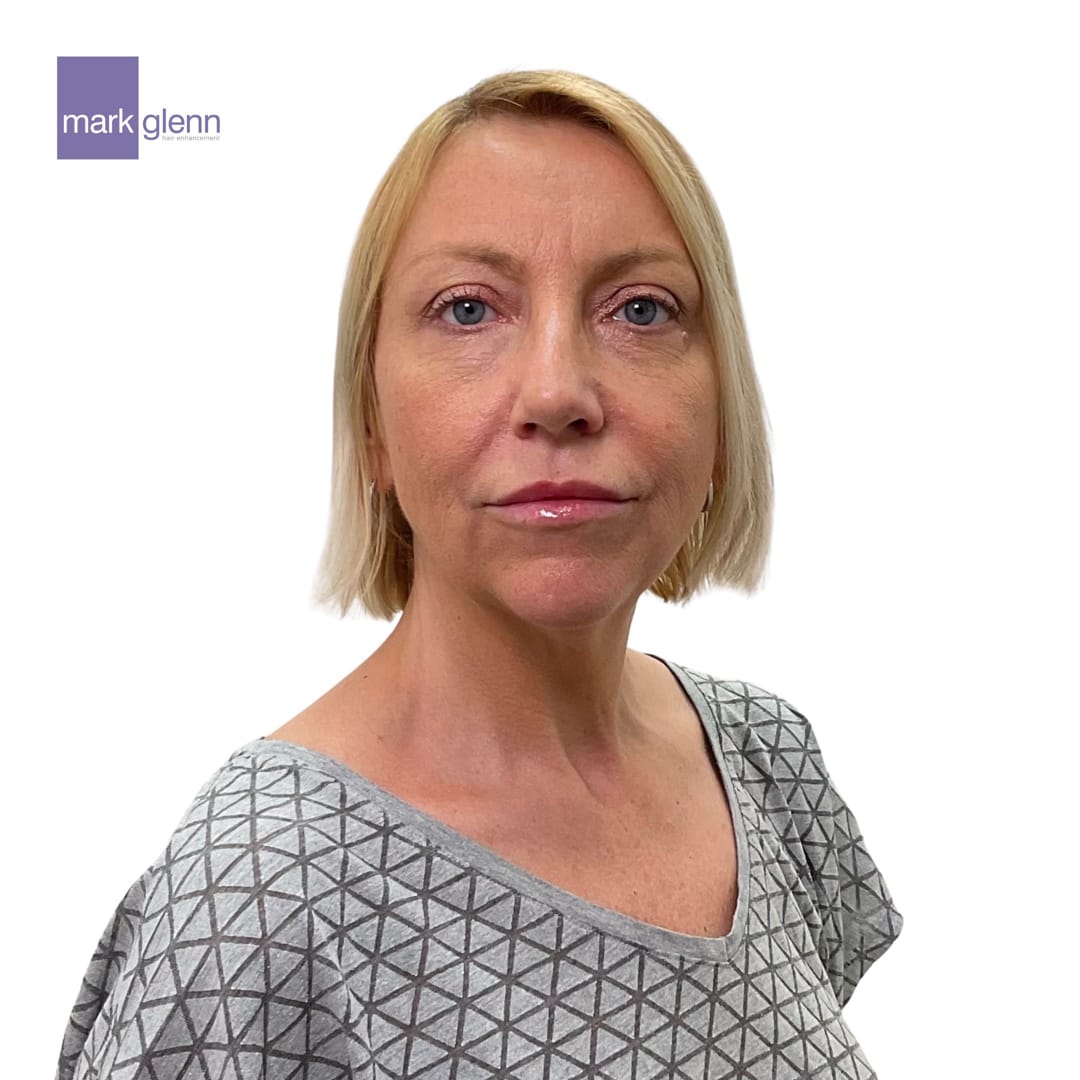 Before Picture - Short to Long, Fine to Thick, Flat to Wavy Guilt-Free Hair Extensions