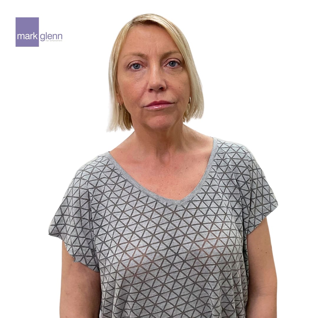 Before Picture - Short to Long, Fine to Thick, Flat to Wavy Guilt-Free Hair Extensions