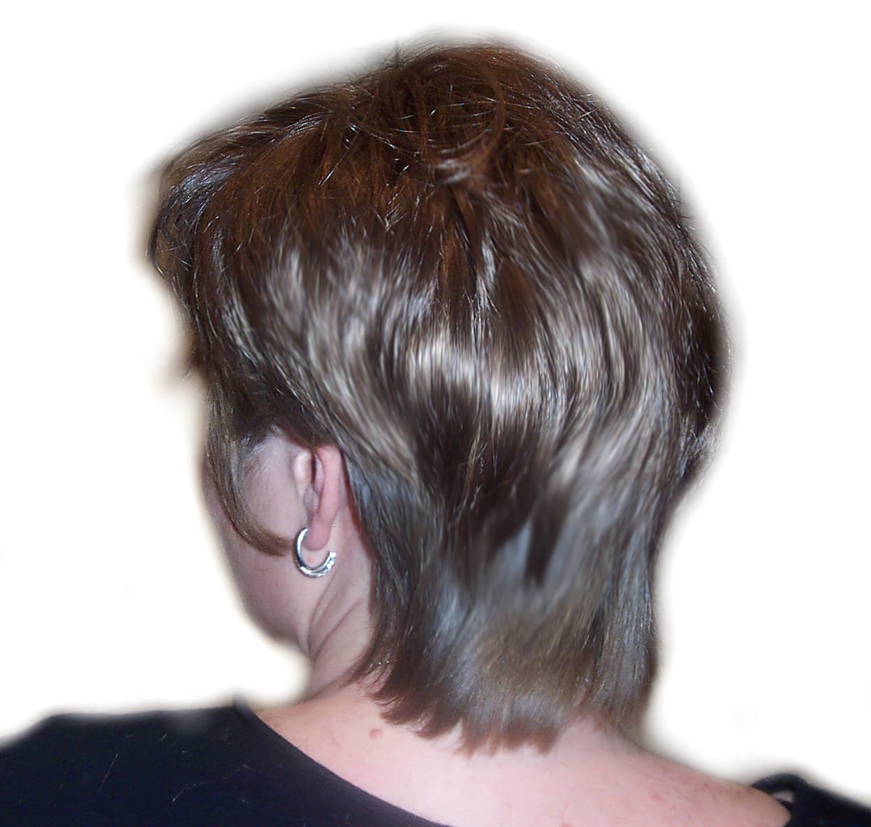 After Picture - Trichotillomania & Full Recovery