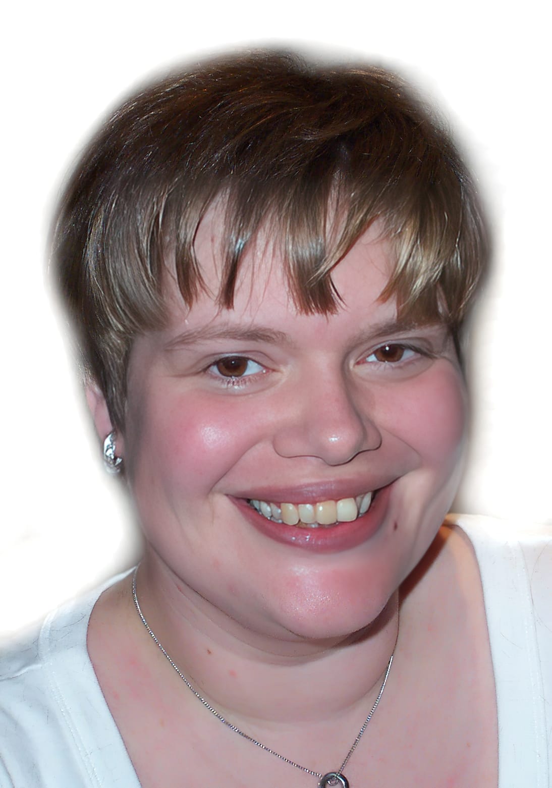 After Picture - Trichotillomania & Full Recovery