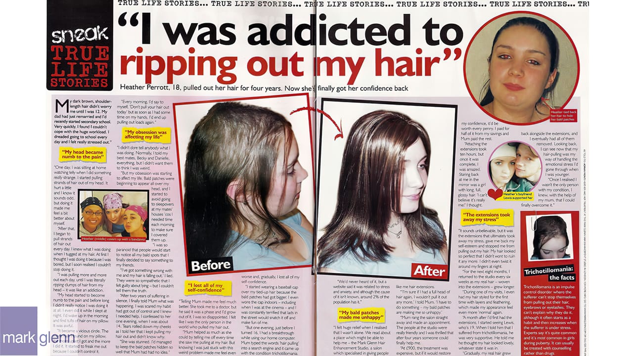 HL005-M - Trichotillomania Success Story - Kinsey System at Mark Glenn, London, UK
