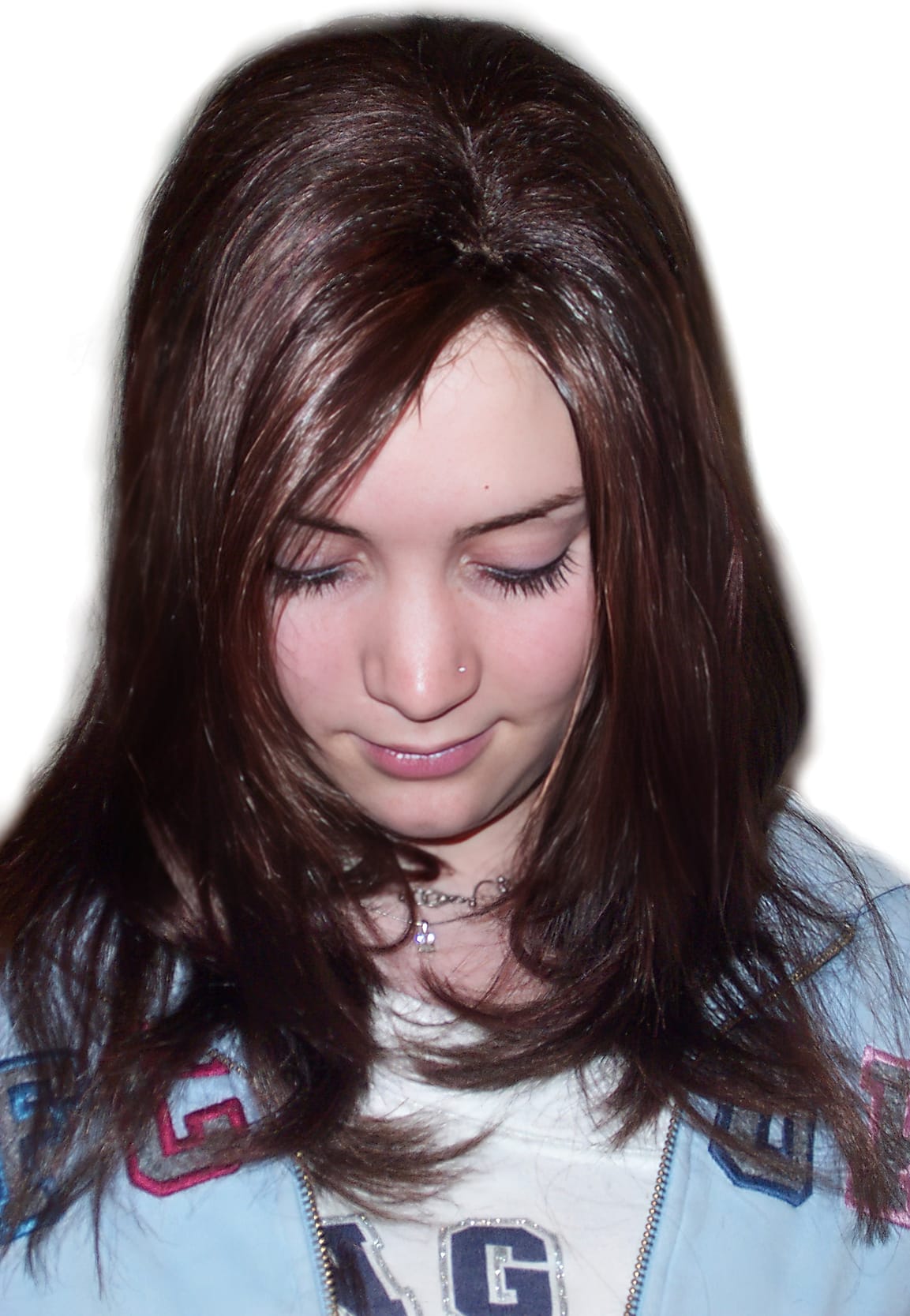 After Picture - Trichotillomania & Full Recovery