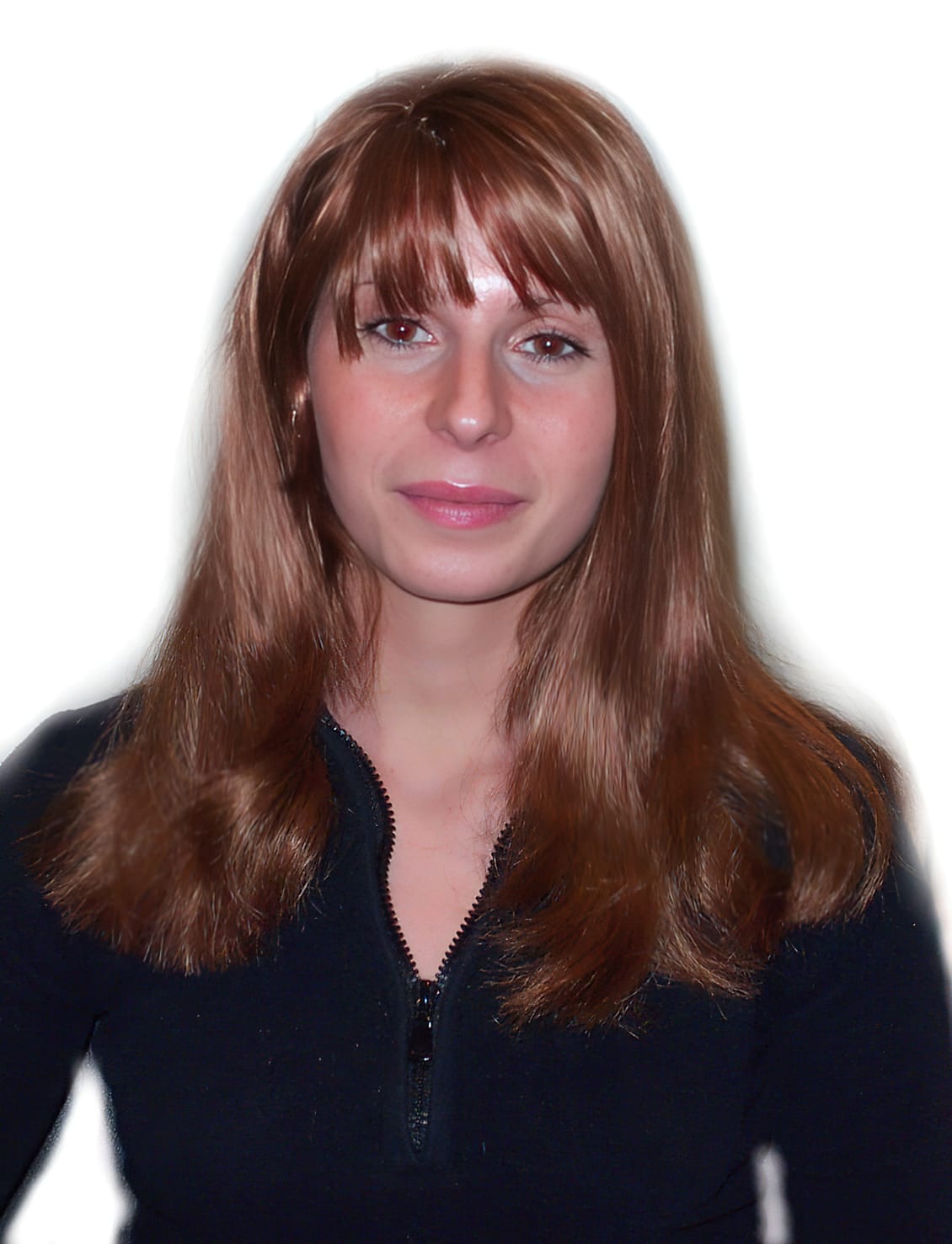 After Picture - Androgenetic Alopecia or Female Pattern Hair Loss