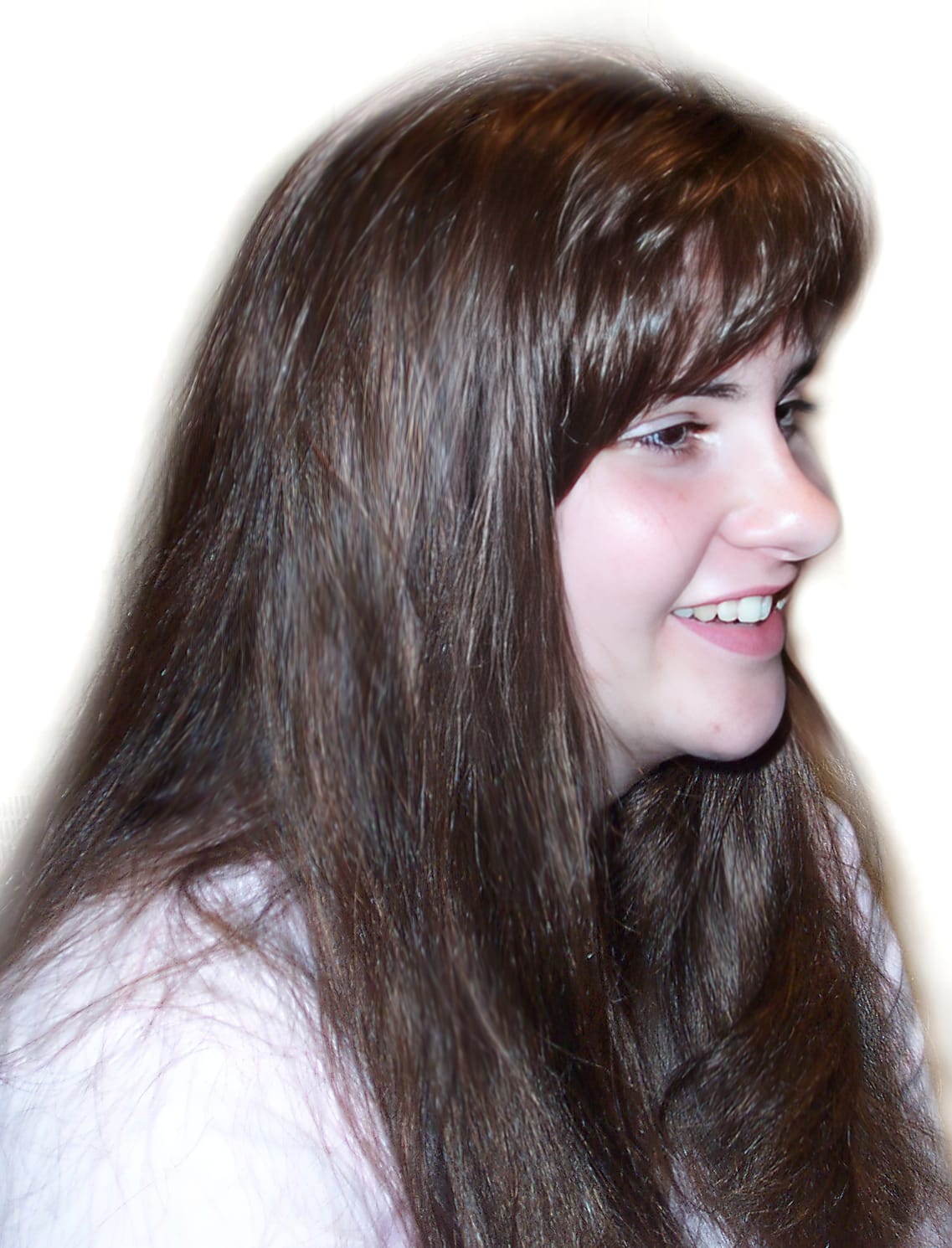 After Picture - Trichotillomania Turnaround