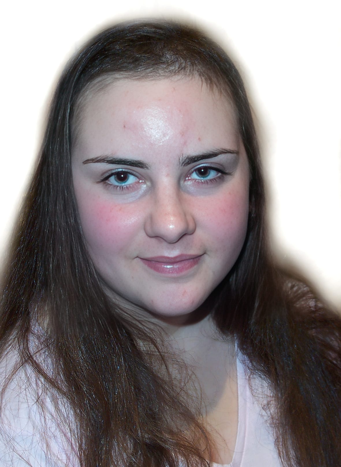 Before Picture - Trichotillomania Turnaround