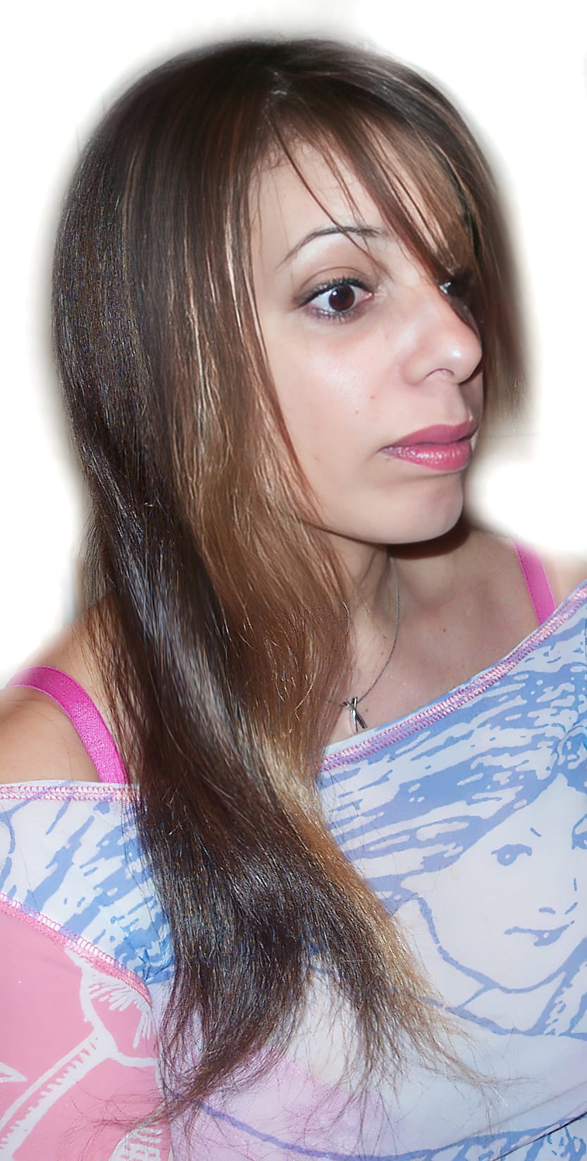 After Picture - Alopecia Areata