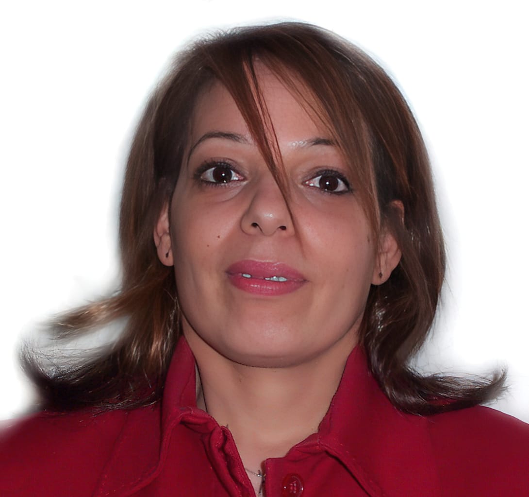 After Picture - Alopecia Areata