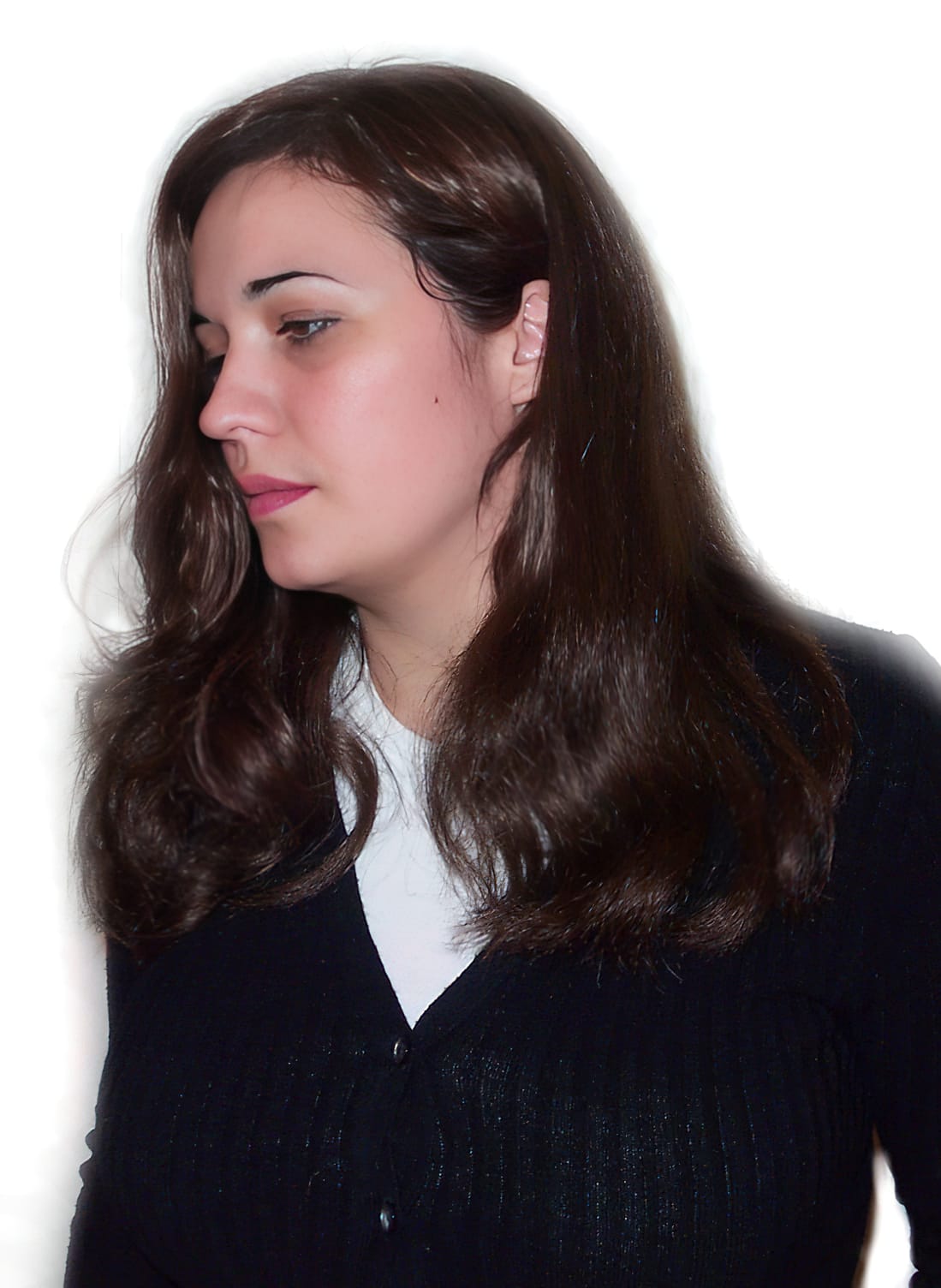 After Picture - Trichotillomania Success - Now Pull-Free