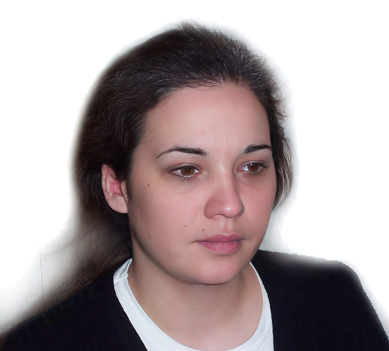 Before Picture - Trichotillomania Success - Now Pull-Free