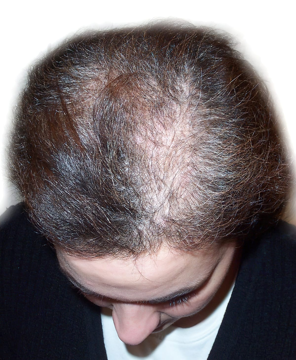 Before