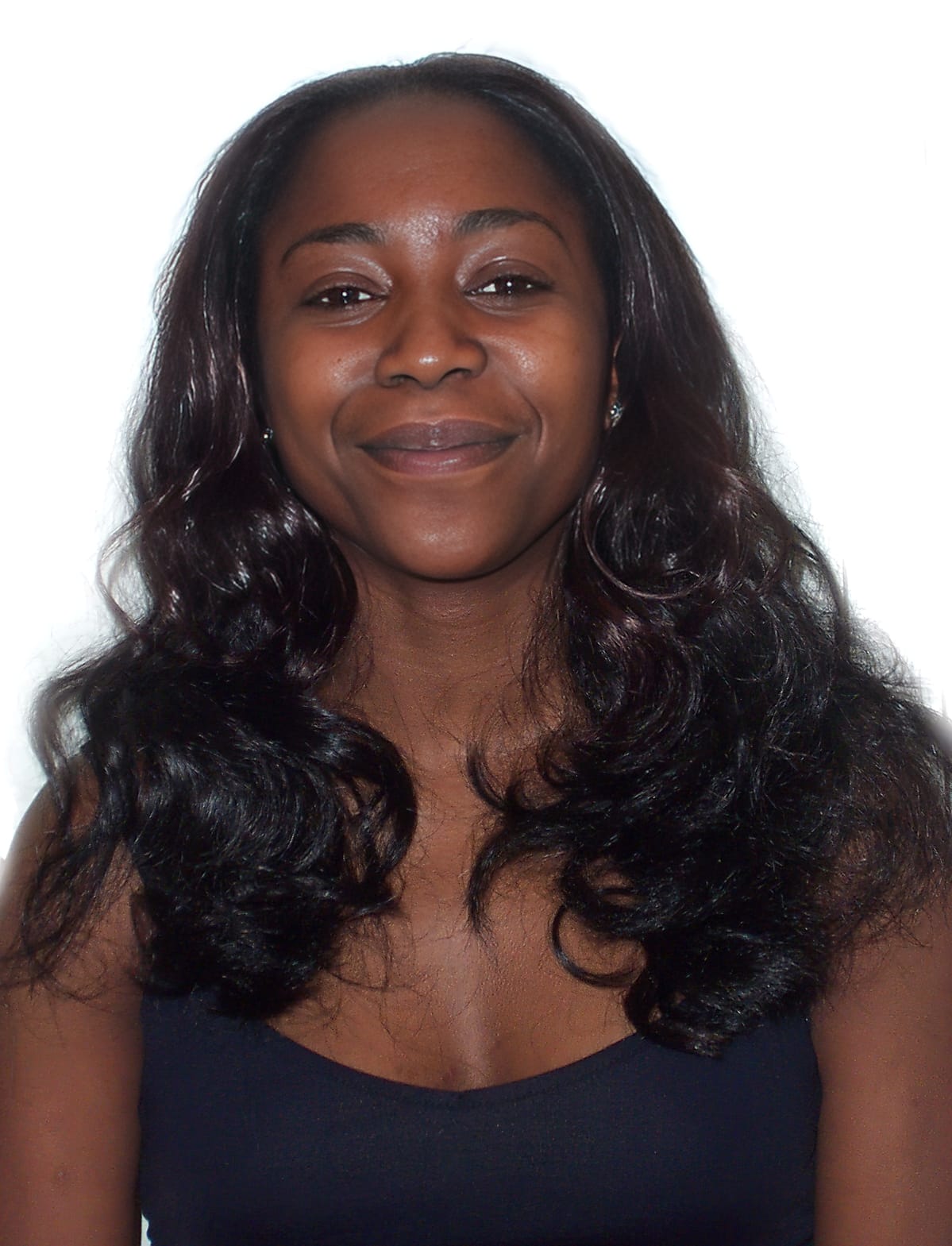 After Picture - Traction Alopecia from Clip-In Hairpiece