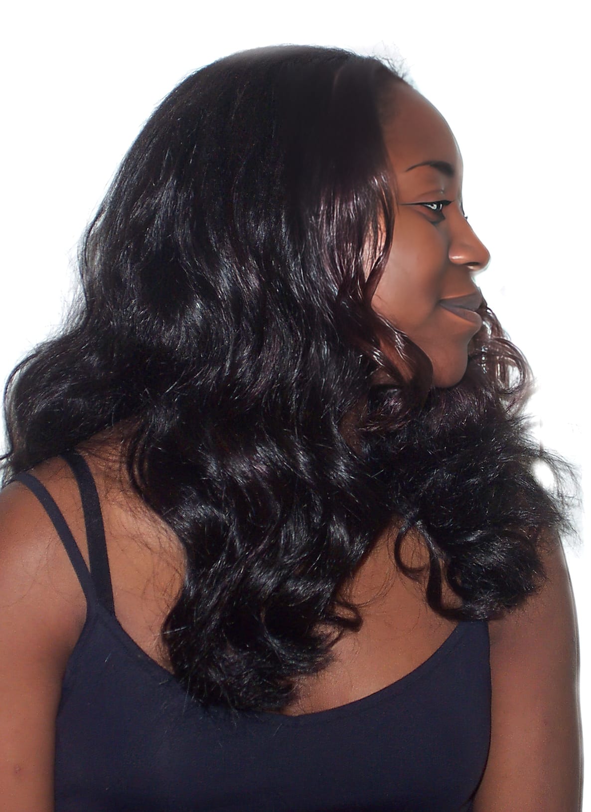 After Picture - Traction Alopecia from Clip-In Hairpiece