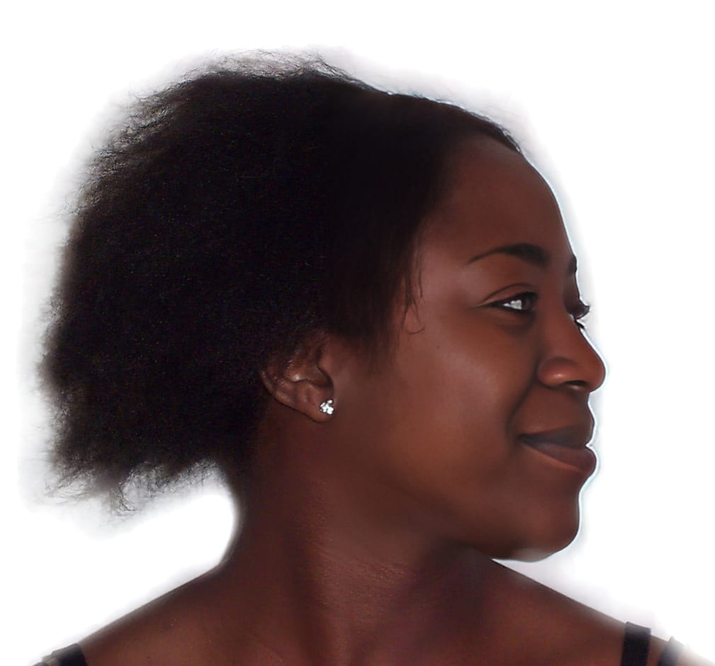Before Picture - Traction Alopecia from Clip-In Hairpiece