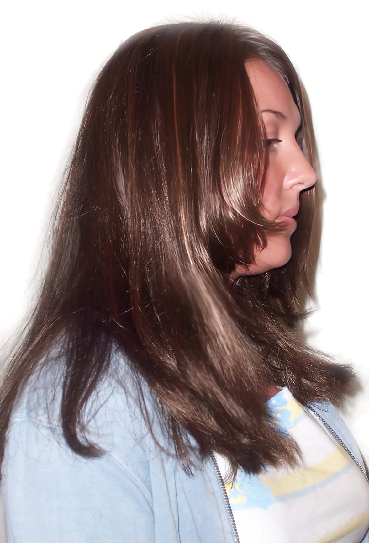 After Picture - Trichotillomania