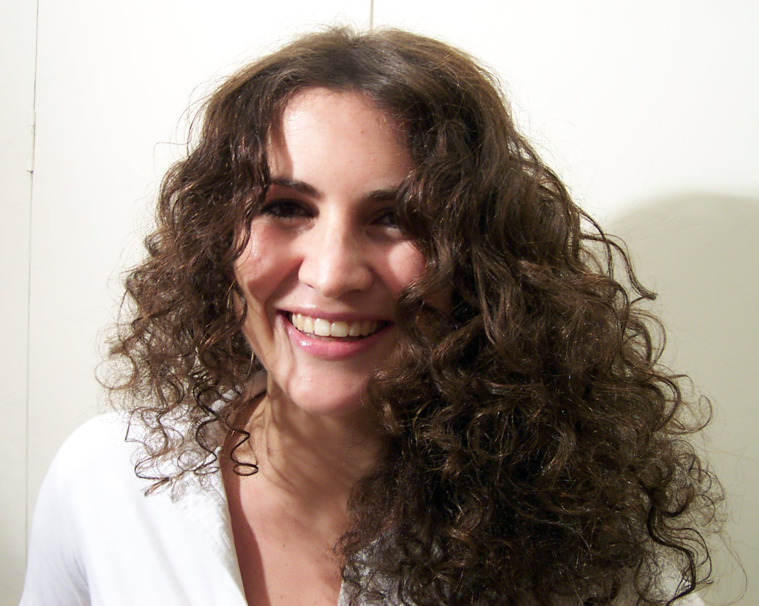 After Picture - Temporary Hormonal Alopecia Sorted