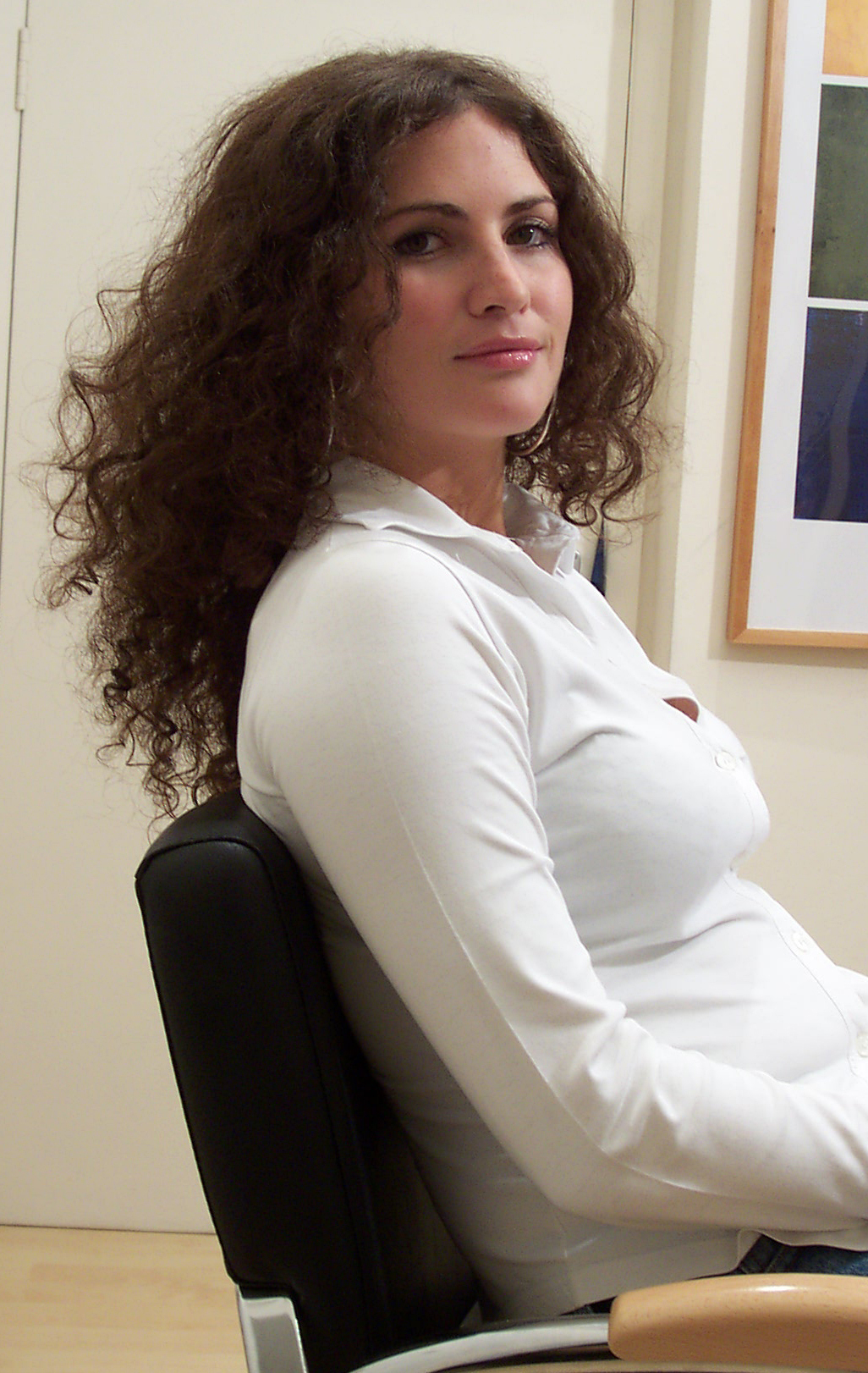 After Picture - Temporary Hormonal Alopecia Sorted