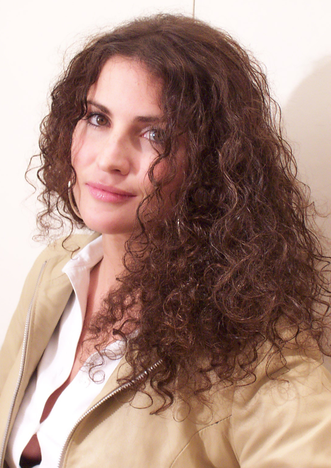 After Picture - Temporary Hormonal Alopecia Sorted