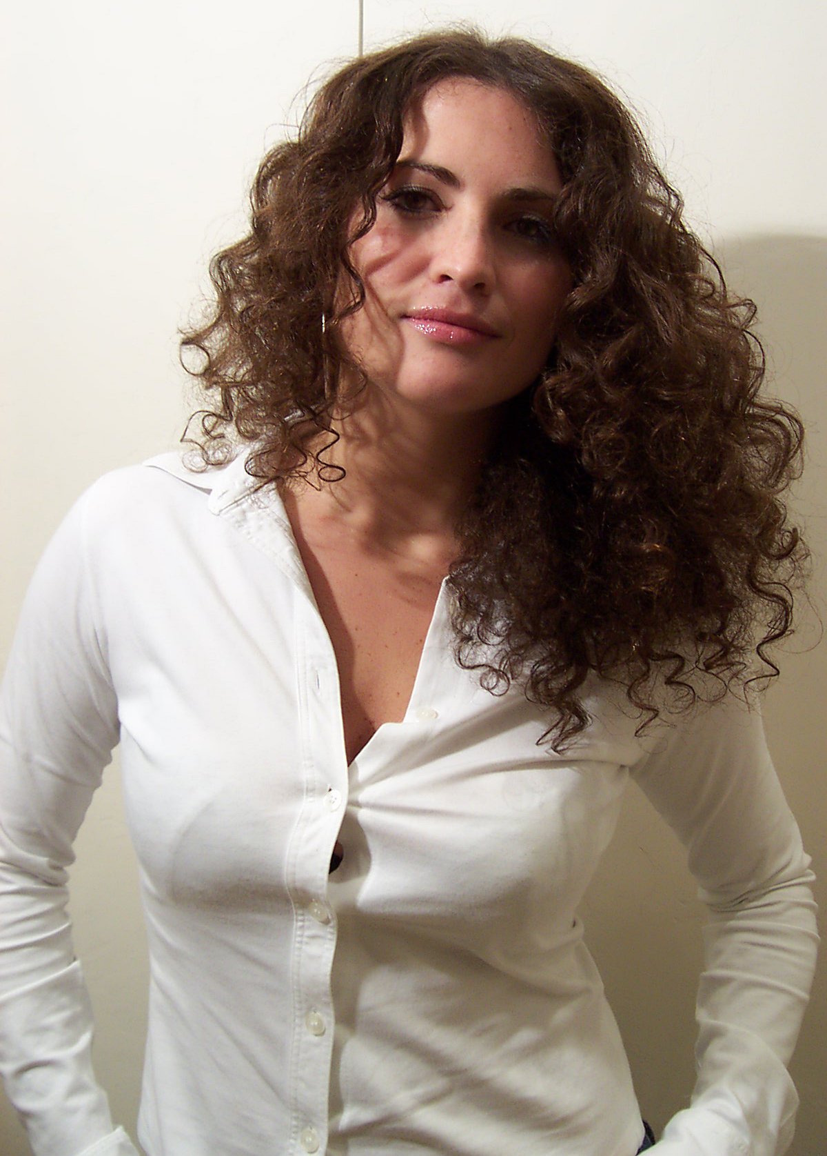 After Picture - Temporary Hormonal Alopecia Sorted