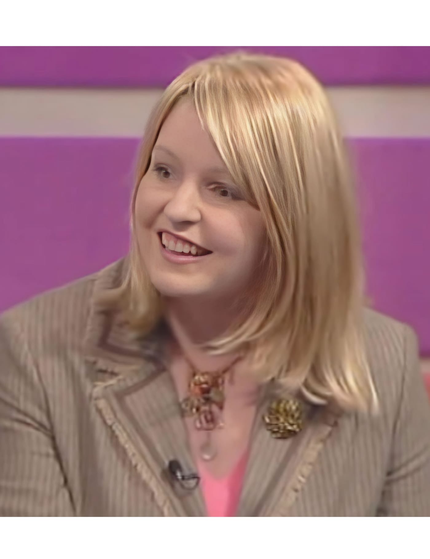 After Picture - Endometriosis Hair Loss Miracle Makeover - TV