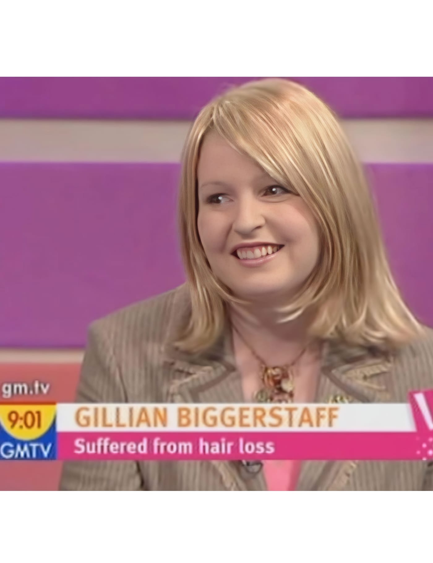 After Picture - Endometriosis Hair Loss Miracle Makeover - TV